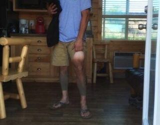 Aaron in a cabin, showing off the dirt tan line on his legs after the race